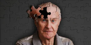 La enfermedad de Alzheimer es la principal causa de demencia